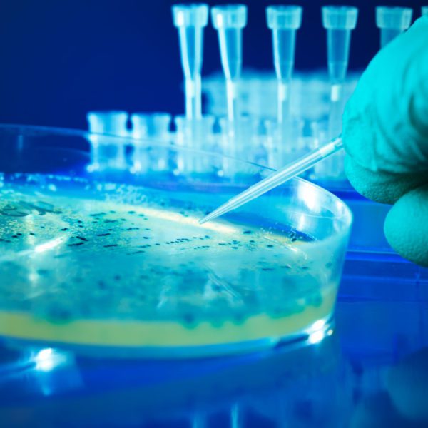 Biofilm Engineering Report