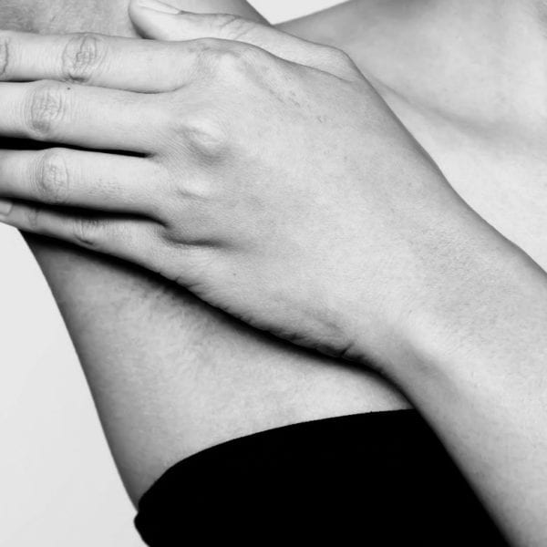 Hidradenitis Suppurativa: Can biofilm research support treatment?