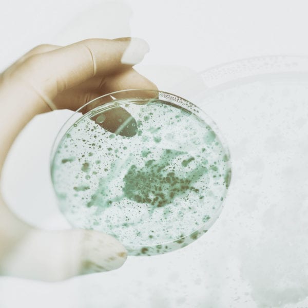 Biofilm Management Report