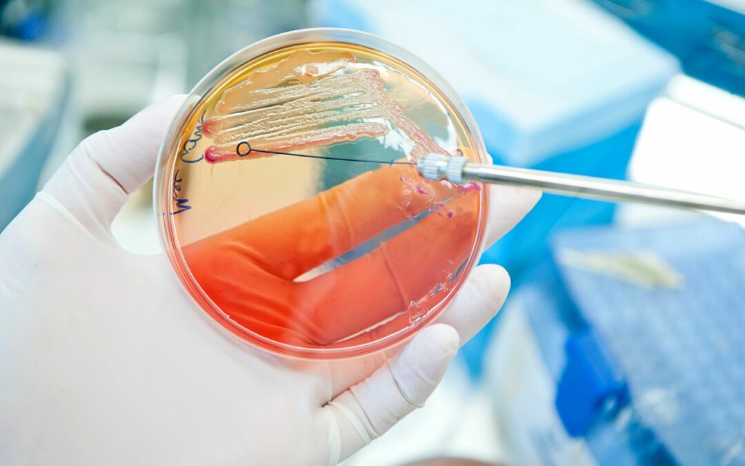 Cardiff University PhD: biofilm disruption in AMR E. coli