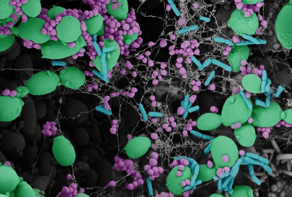 cpd-polymcirobial_011 false coloured Biofilm Photography