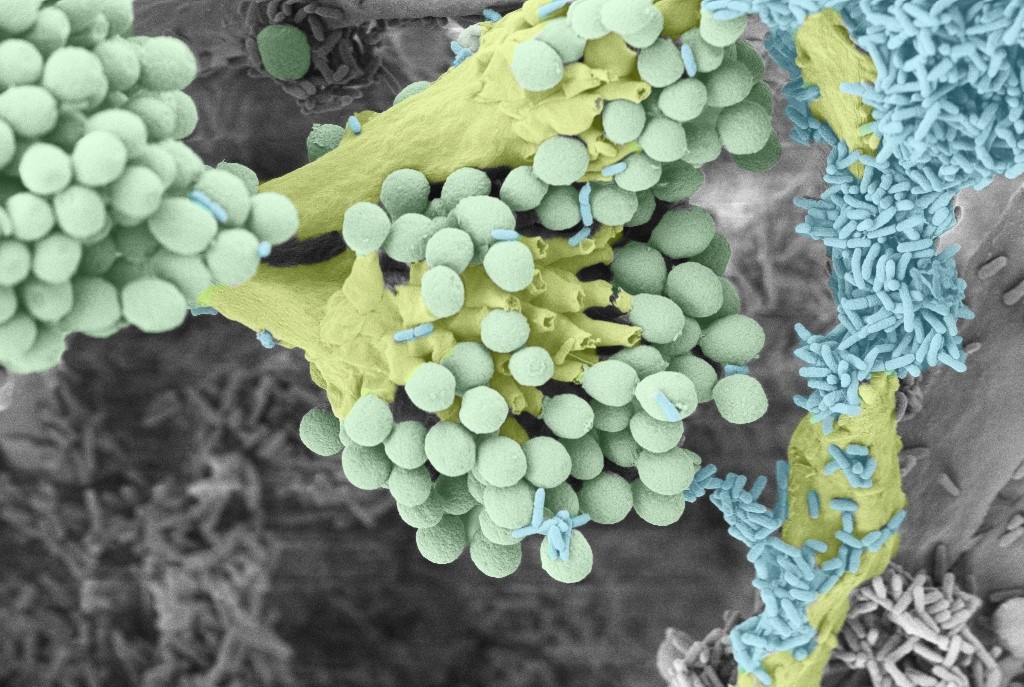 ID 3 Biofilm Photography