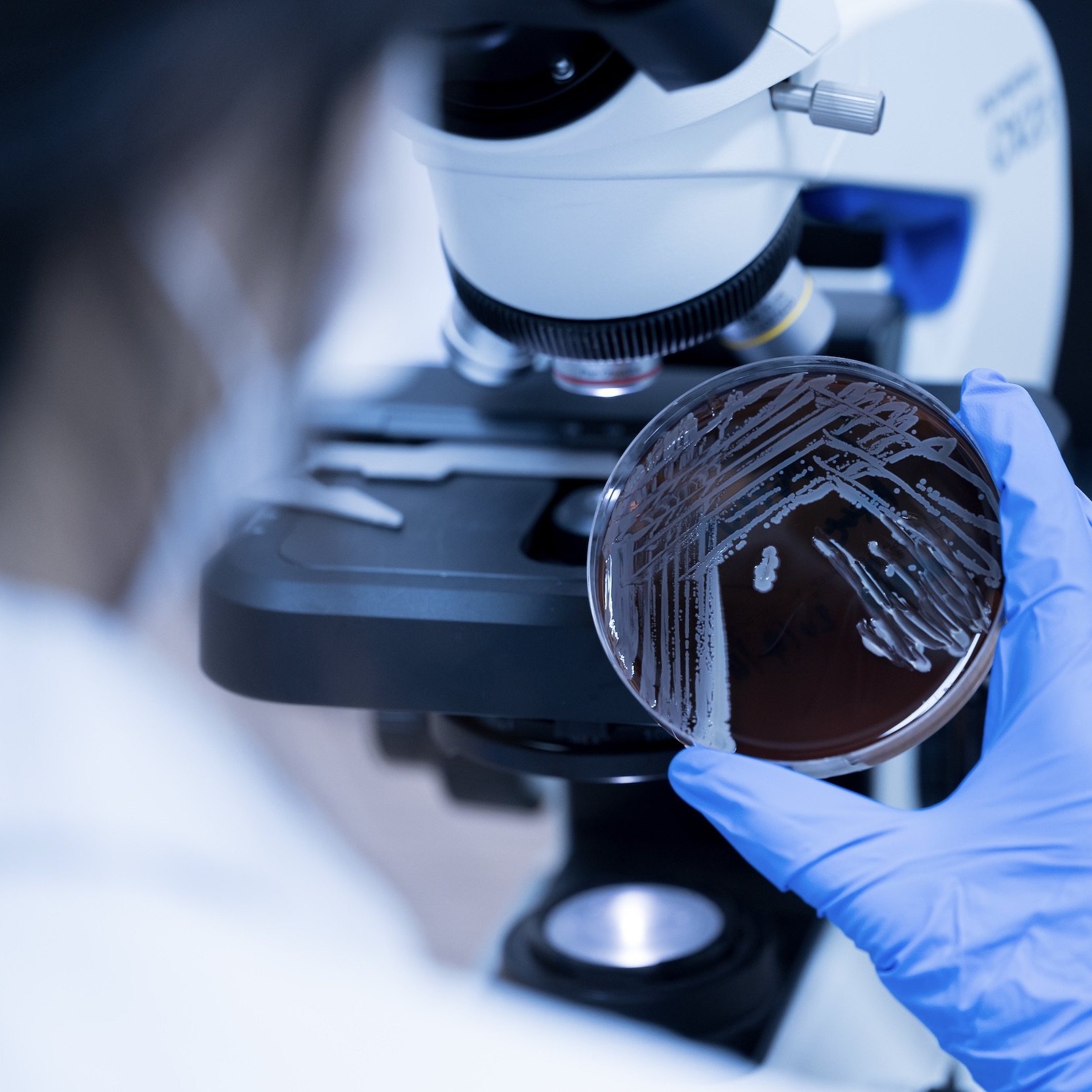 Biofilm Challenges